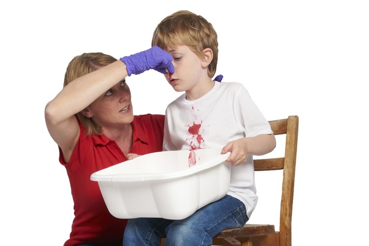 first aid at home for bleeding nose